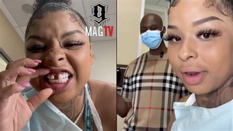 why does chrisean rock have a missing tooth|Chrisean Rock Gets Her Tooth Fixed & Says She Wants A Gap